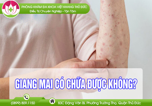 bệnh giang mai có chữa được không