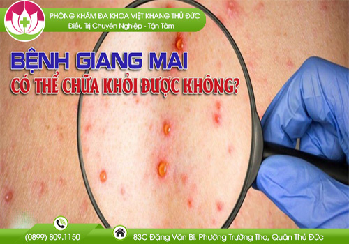 bệnh giang mai có chữa được không